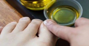 Essential oils for the fight against fungus