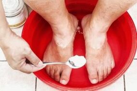 A bath with soda and tar soap will get rid of the fungus on the legs